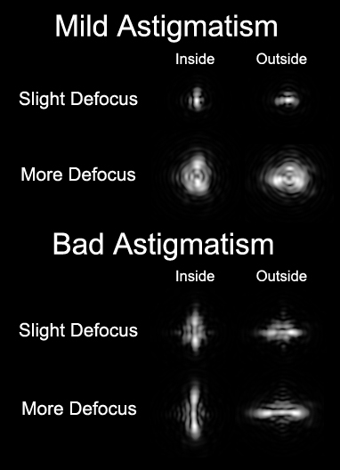 Astigmatism